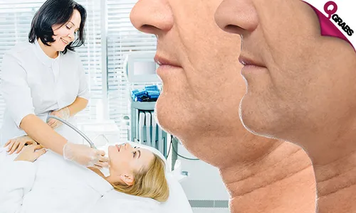 Morpheus8: Tightening & Lifting Treatment for Face & Neck!